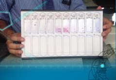 Frozen section sample